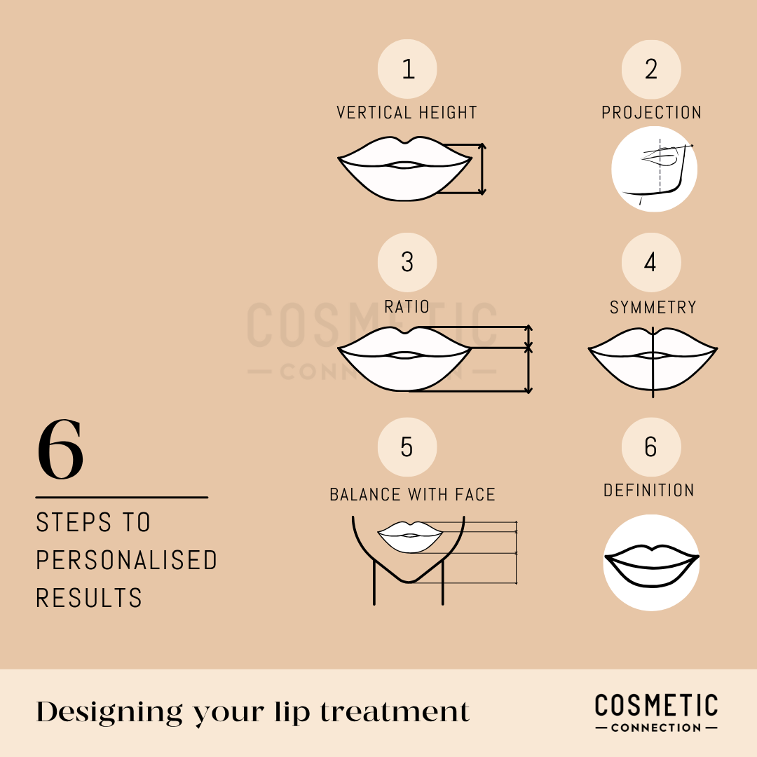 Infographic showing 6 steps to personalized lip treatment: vertical height, projection, ratio, symmetry, balance with face, and definition, each with a simple lip illustration on a beige background.