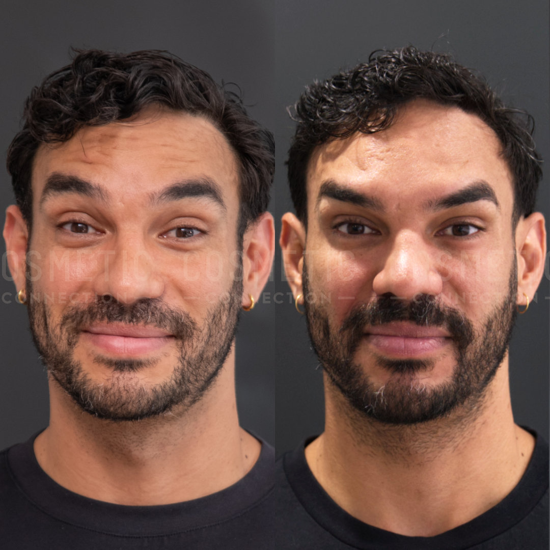 Side-by-side images of a man with curly hair and facial hair. Both images show him wearing a black shirt, with slight differences in his facial expression and lighting.