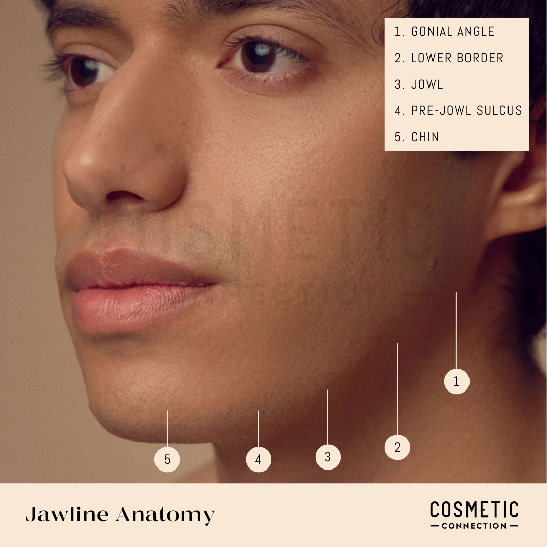 Close-up of a persons jawline with labels pointing to parts of the anatomy: 1. Gonial Angle, 2. Lower Border, 3. Jowl, 4. Pre-Jowl Sulcus, 5. Chin. The background is neutral, and the text reads Jawline Anatomy from Cosmetic Connection.