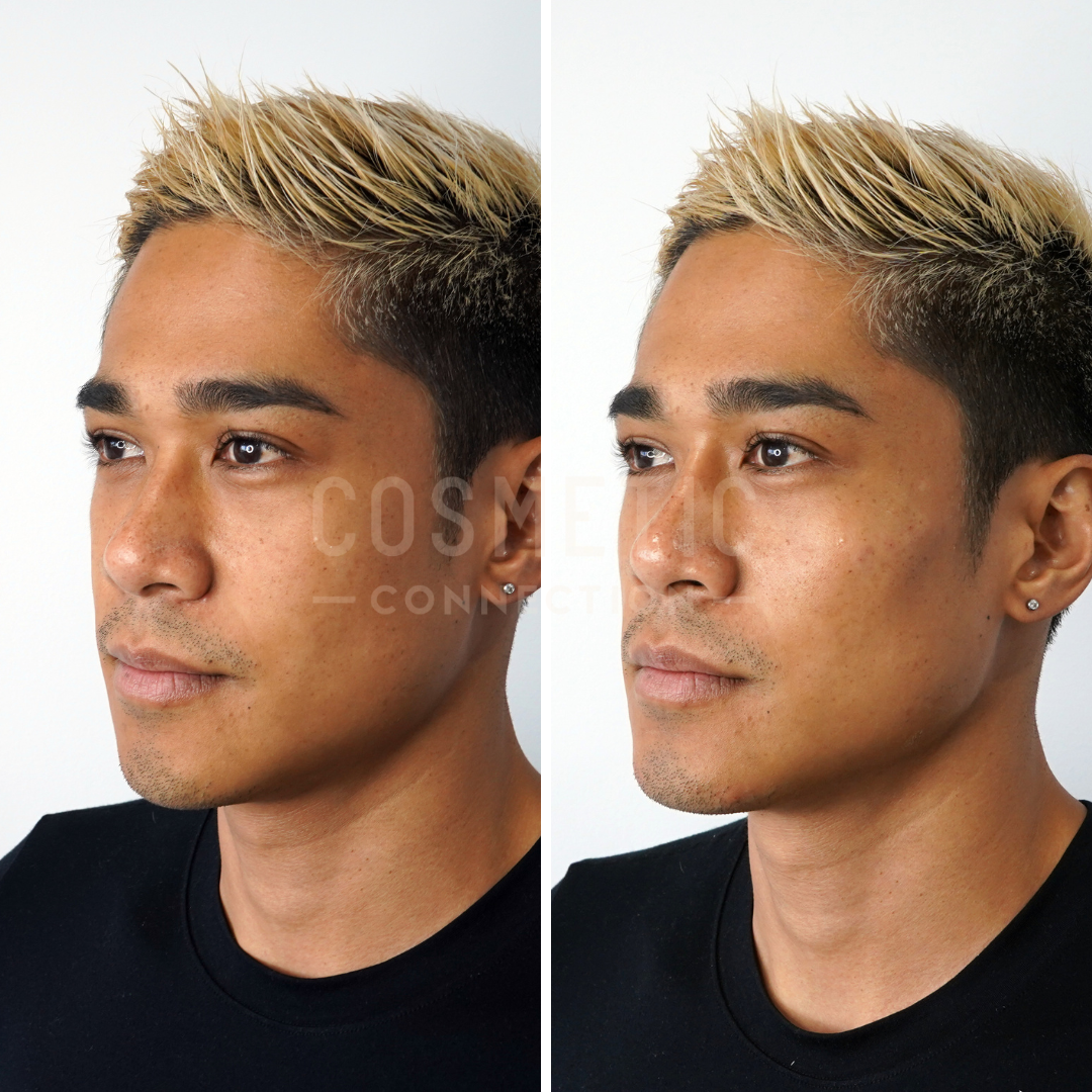 Side-by-side comparison of a person with blond-tipped hair and earrings, showing subtle differences in skin texture and hair color. The left image shows a slightly softer appearance, while the right features a sharper look.