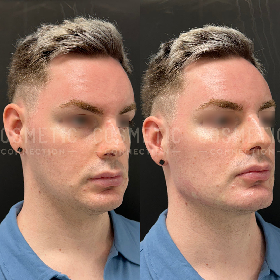 A person with short hair and wearing a blue shirt is shown in two side-by-side images. The background is dark, and text is overlaid across the image. The lighting highlights their facial features.
