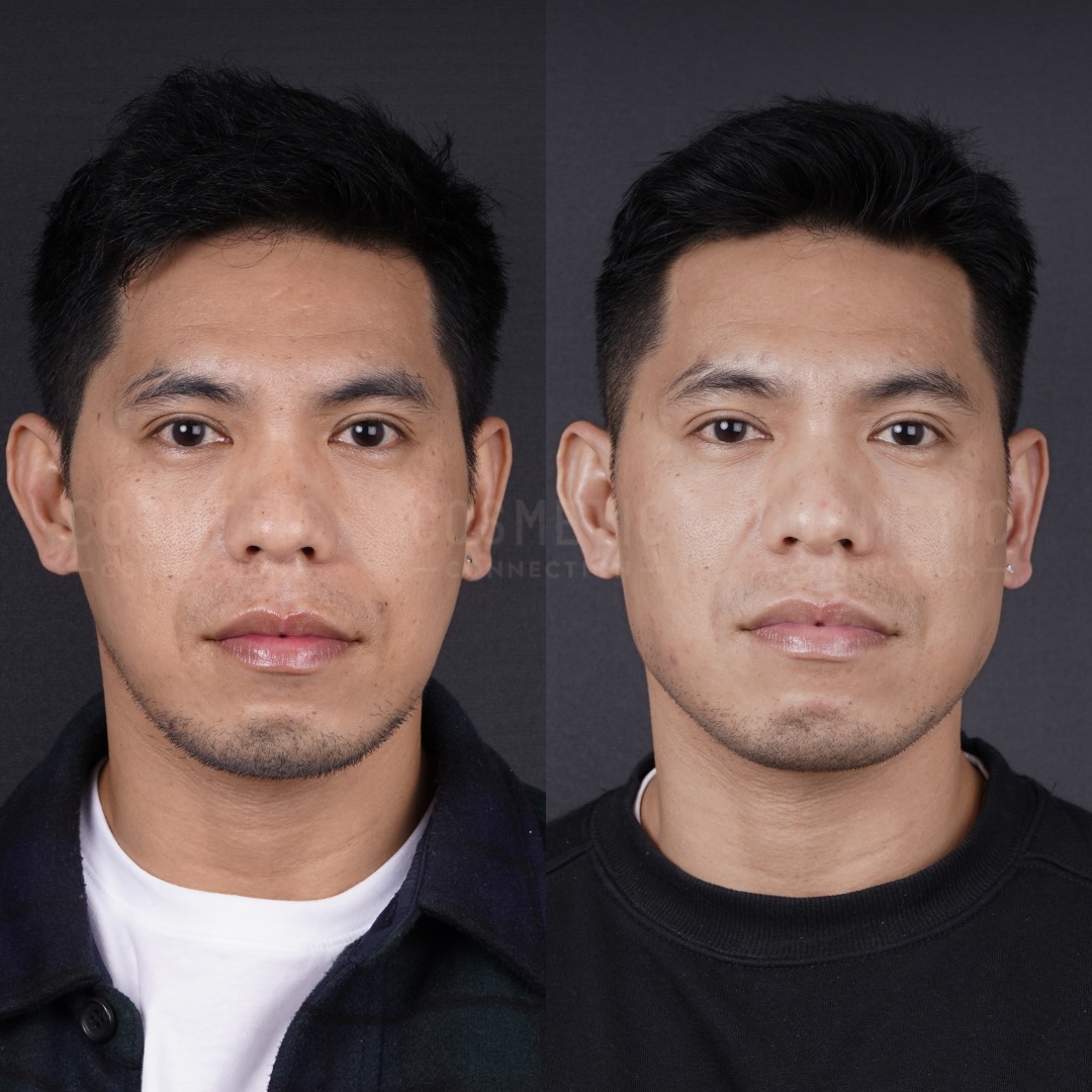 Side-by-side portraits of the same man against a dark background. On the left, he has slightly messy hair and some facial stubble; on the right, his hair is neater and his face appears clean-shaven.