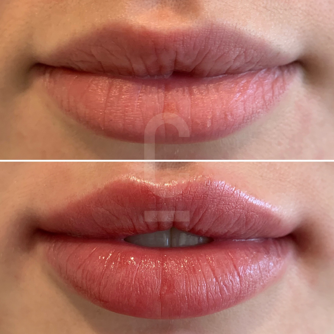 Close-up of lips shown in a before-and-after comparison. The top half shows natural lips, while the bottom half shows the same lips with a glossy reddish-pink tint.