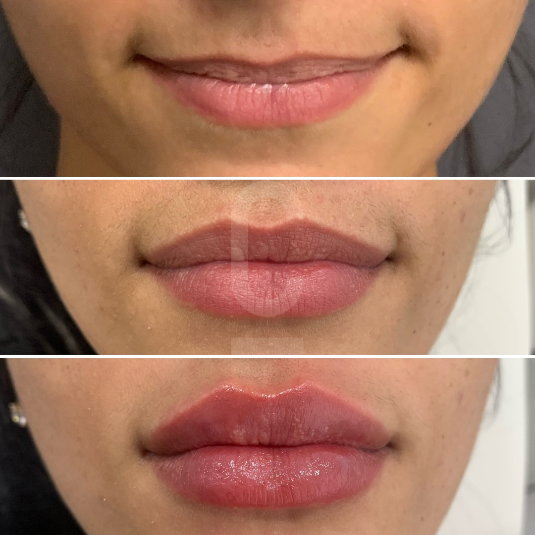 A set of three images shows lips at different stages: natural lips, followed by lips with liner, and finally lips with a glossy finish.