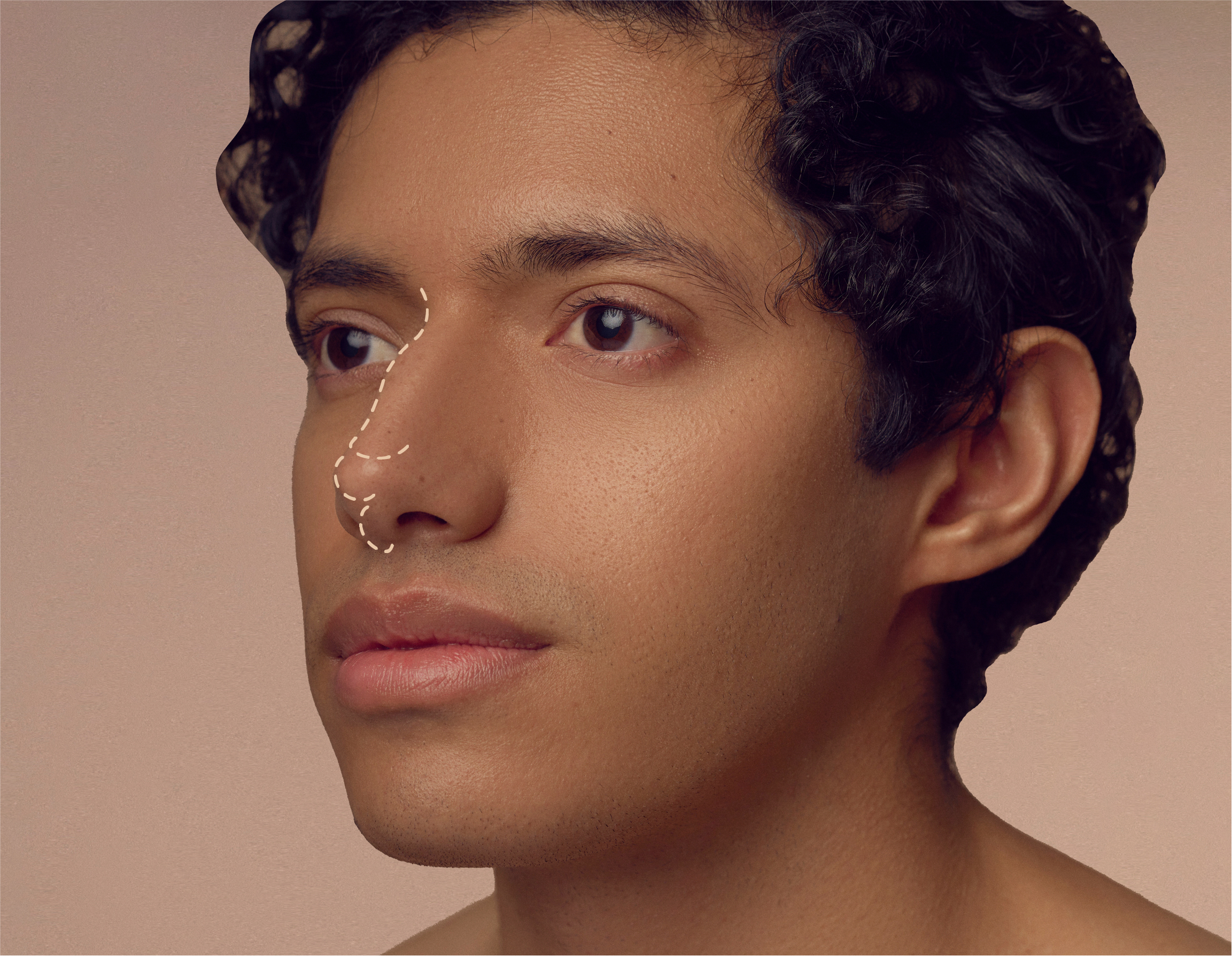 A person with curly hair faces sideways. White dotted lines overlay the nose, indicating potential cosmetic surgery areas. The background is neutral beige.