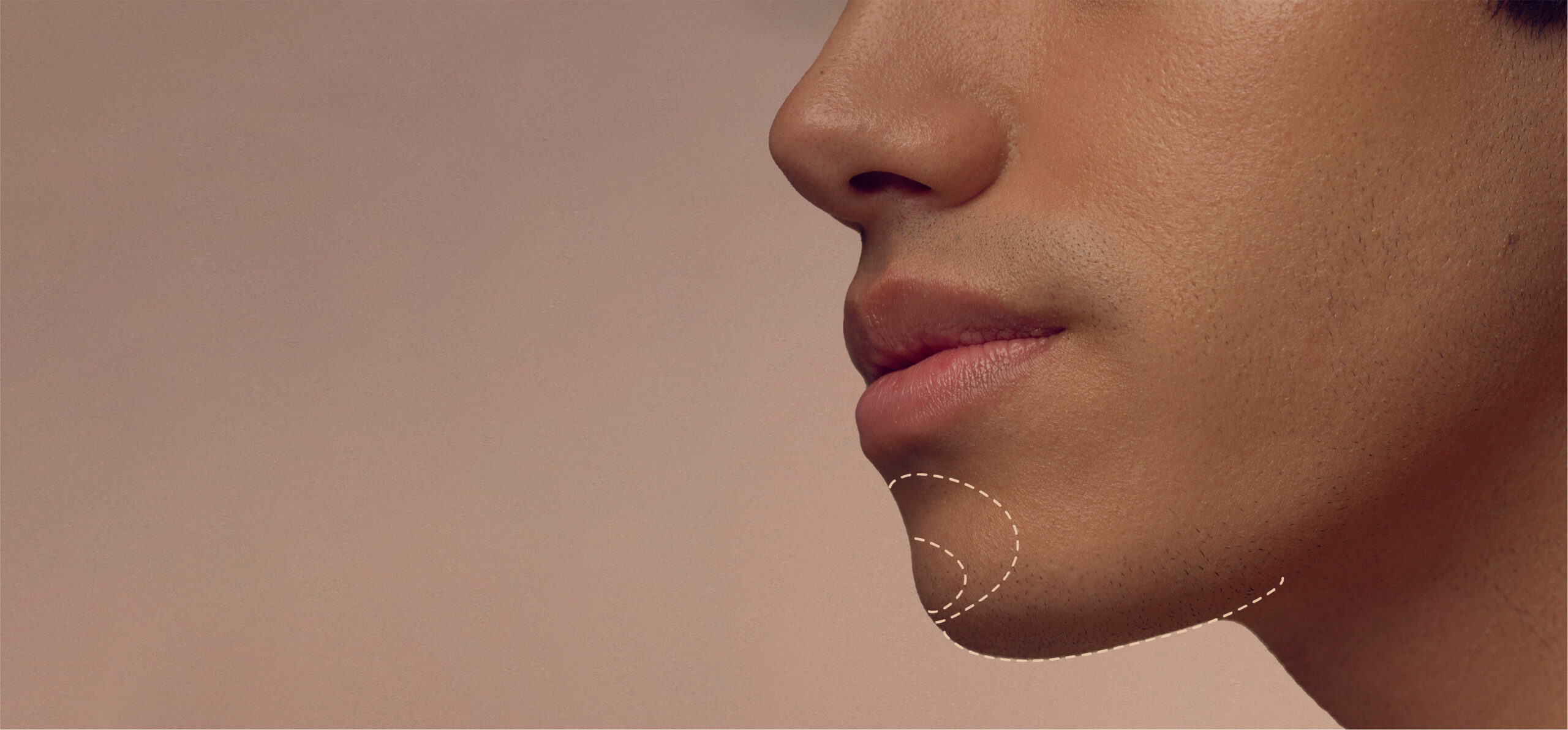 Close-up of a persons lower half of the face showing smooth skin and lips. A dotted outline highlights the chin area against a neutral background.