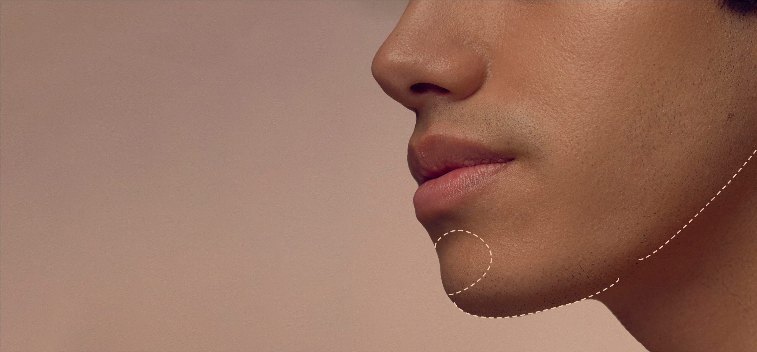 Close-up of a persons lower face, focusing on the chin and lips. A dotted line outlines the chin, possibly indicating a beauty or medical concept. Background is a neutral gradient.