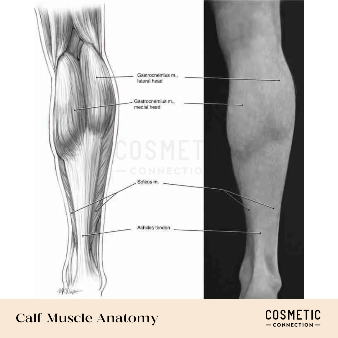 A black and white illustration showing the anatomy of the calf. The image includes labeled parts: gastrocnemius muscle (lateral and medial head), soleus, and Achilles tendon. Alongside is a photo of a calf from the back view.