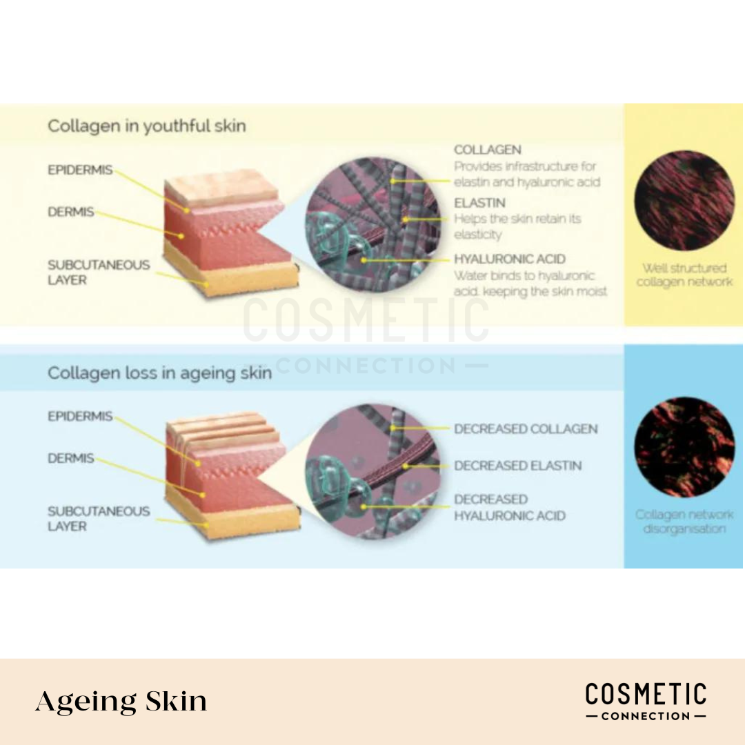 Infographic comparing youthful and aging skin. Top section shows layers with collagen, elastin, and hyaluronic acid in youthful skin. Bottom section shows decreased collagen, elastin, and acid in aging skin. Text explains structural differences.