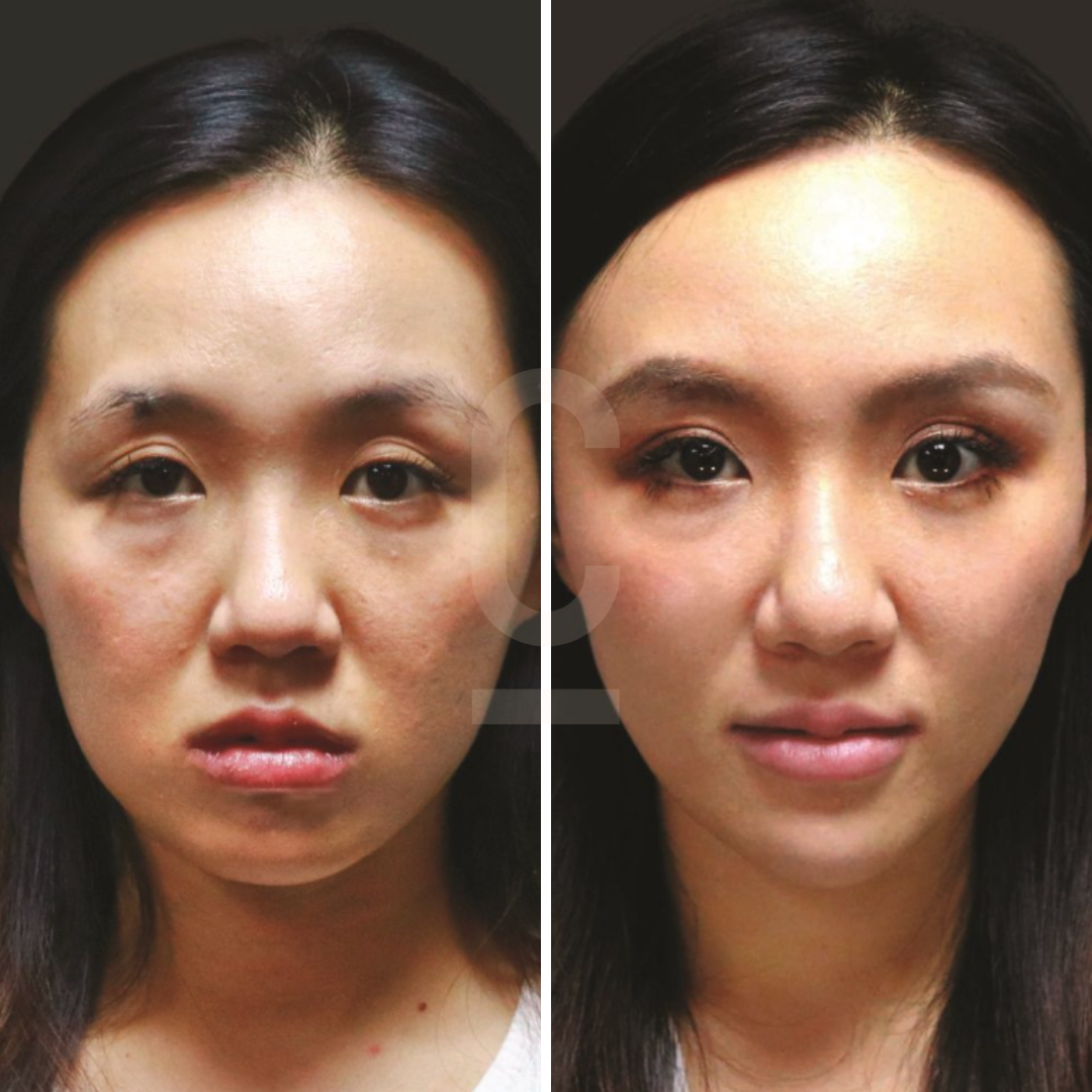 Two side-by-side images of a woman. The left shows her with minimal makeup and slightly uneven skin tone; the right shows her with makeup, even skin tone, and defined features.