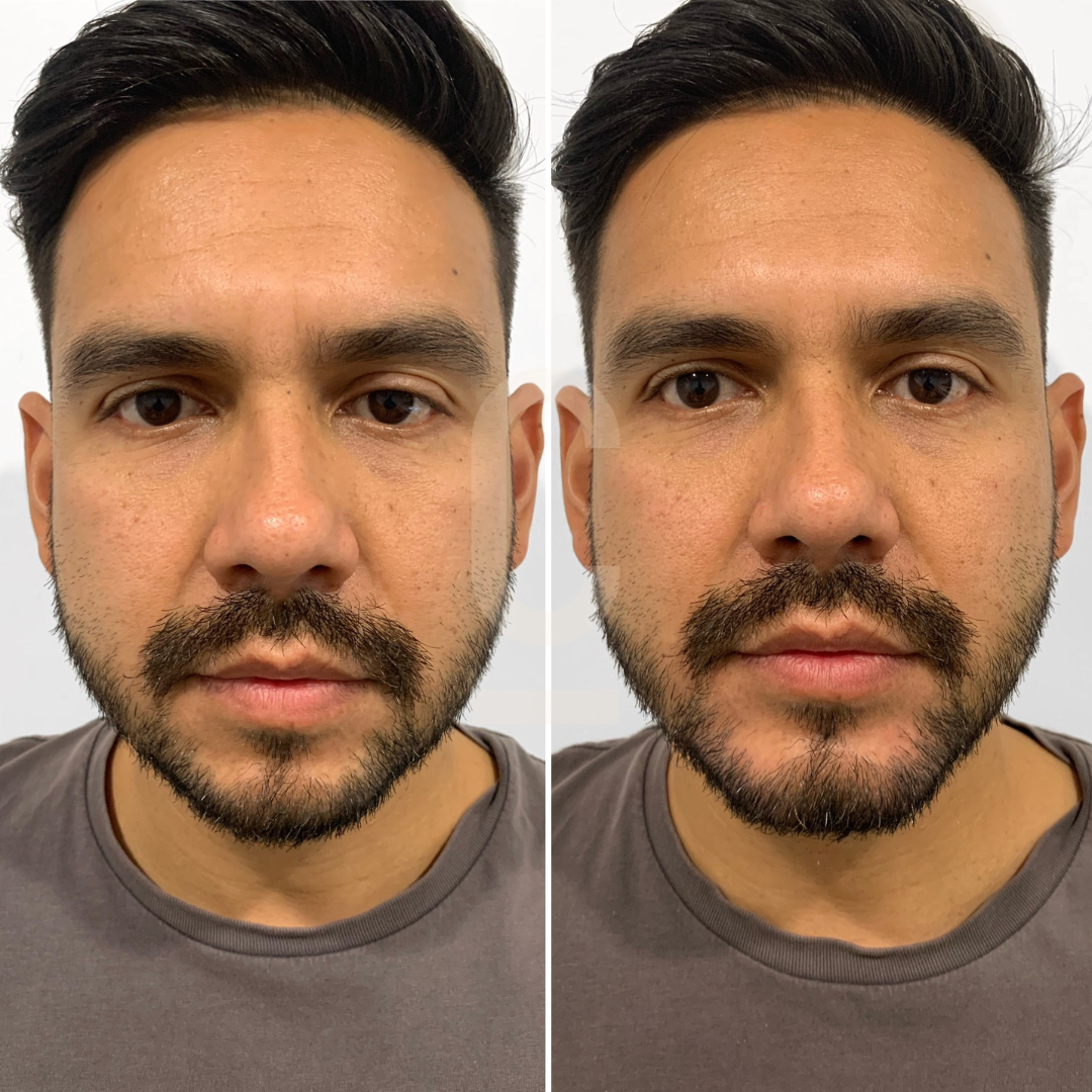 Two side-by-side images of a man with a beard and short hair, wearing a gray shirt. The left image shows him with a neutral expression, and the right image shows a slight change in expression or grooming. White background.