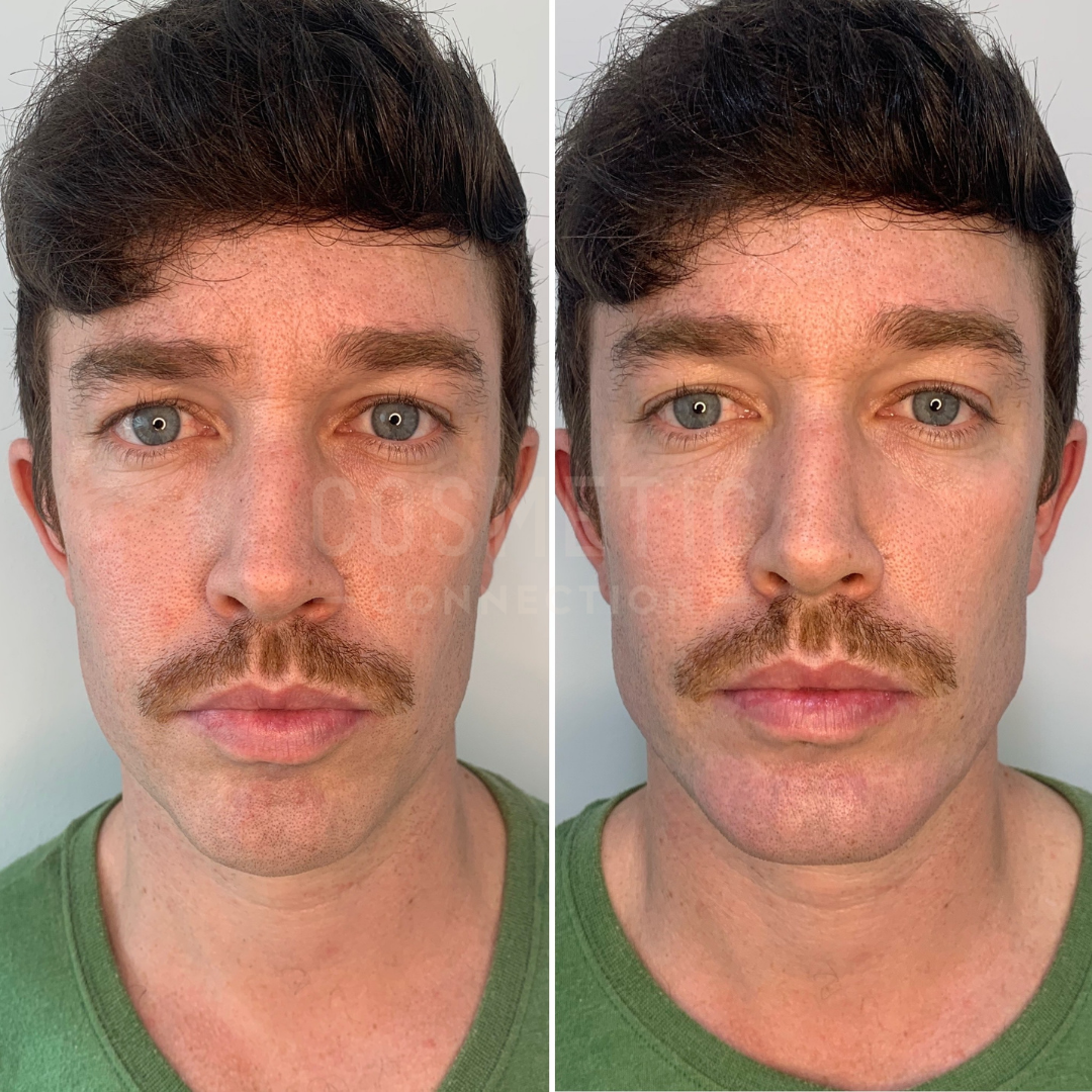 Close-up of a man with brown hair and a mustache in two side-by-side images. He wears a green shirt and looks directly at the camera, showing a neutral expression. The background is plain white.