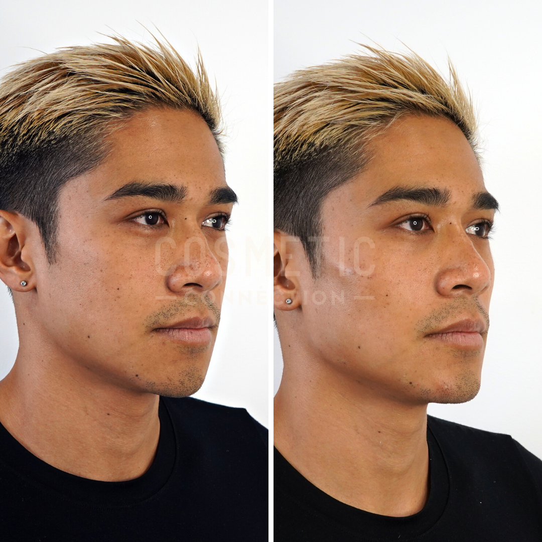 Side-by-side comparison of a person showing a before and after view. The left image shows the person with a natural hairstyle, while the right image highlights the person with a styled and highlighted hair. The person is wearing a black shirt.