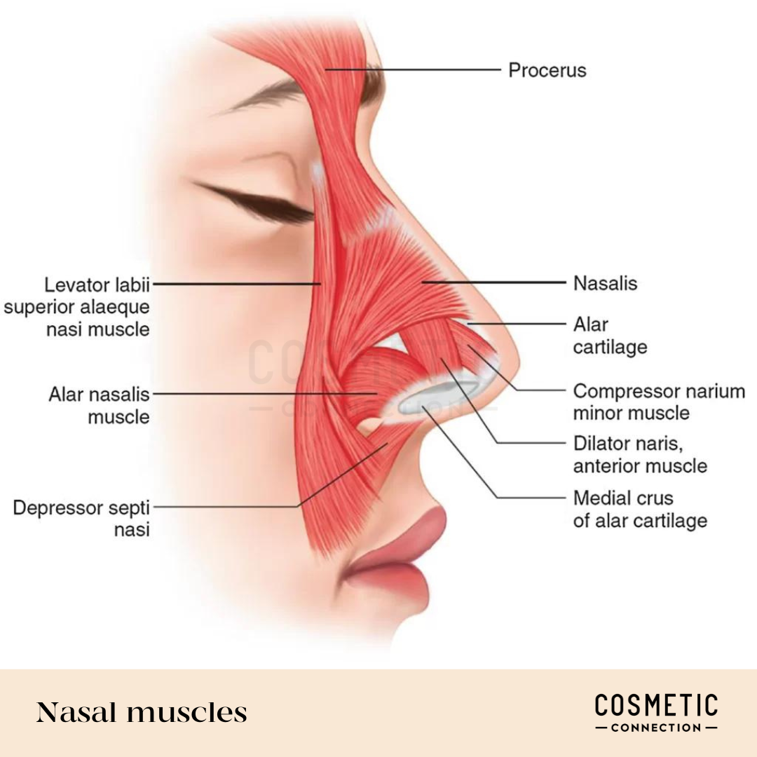 Illustration of facial muscles focused on the nasal area. Labels point to various muscles such as the procerus, nasalis, alar cartilage, and others, depicting their locations and connections around the nose and mouth.